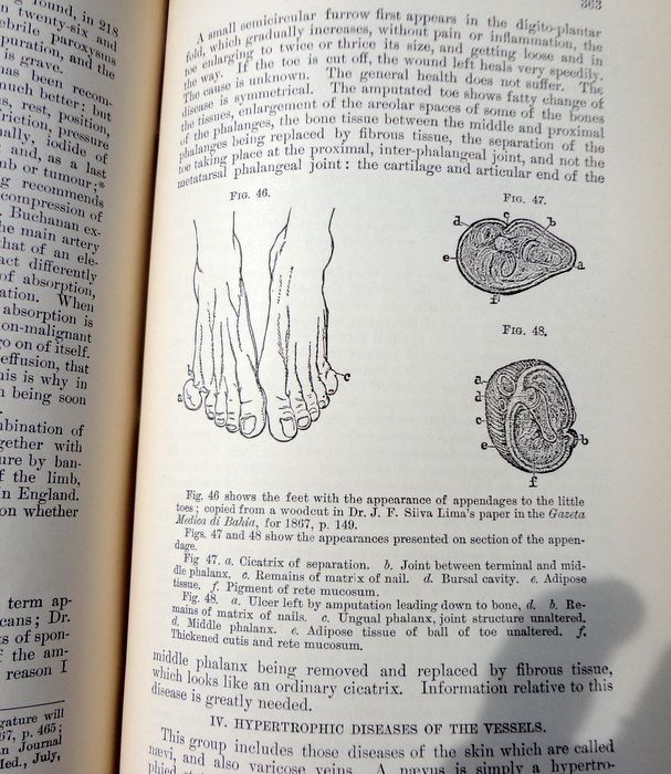 1875 Skin Diseases: Their Description, Pathology, Diagnosis, & Treatment By Tilbury Fox M. D. 1875 Skin Diseases: Their Description, Pathology, Diagnosis, & Treatment By Tilbury Fox M. D.