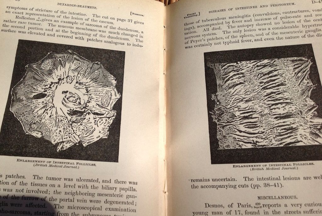 Five Volume Set 1893 Annual Of The Universal Medical Sciences Five Volume Set 1893 Annual Of The Universal Medical Sciences